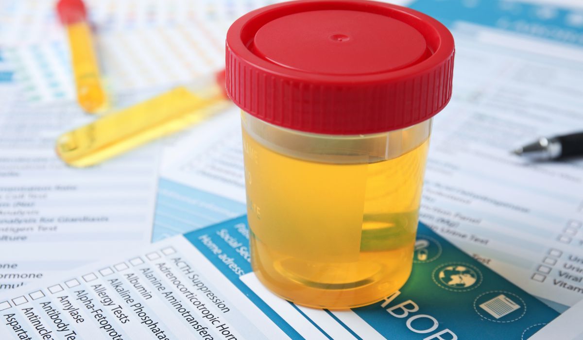 urine sample during drug testing