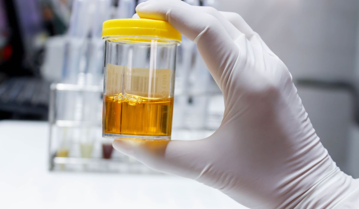 How Long Does Cocaine Stay in Your Urine